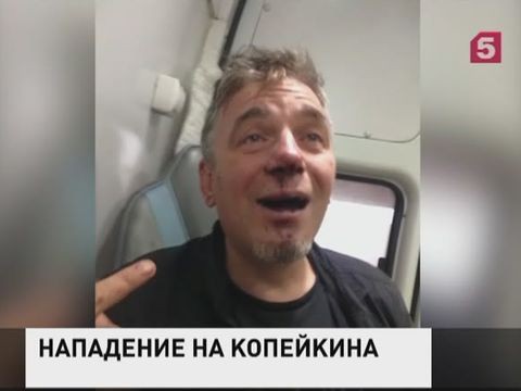 В Петербурге избили и ограбили художника Николая Копейкина