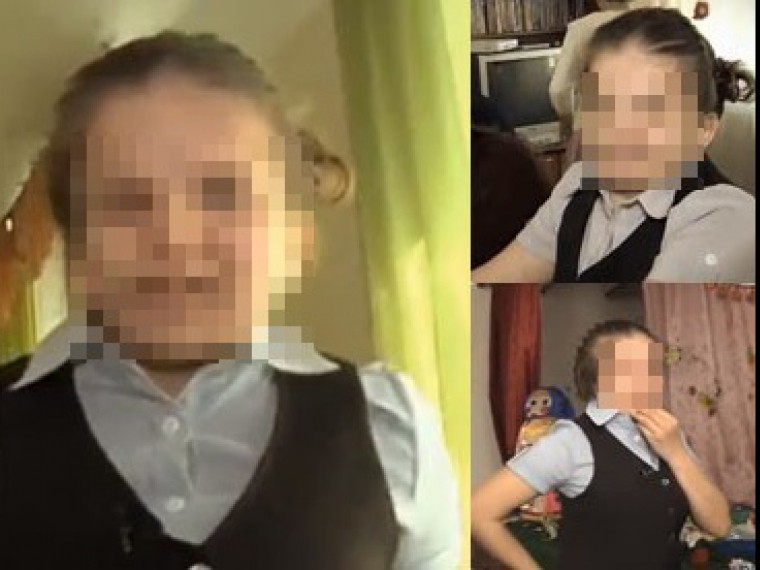 Девочка с деформацией лица, которой пообещали помочь в эфире телешоу, скончалась во время операции в Москве